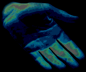 Hand